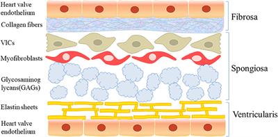 Pathogenesis and Molecular Immune Mechanism of Calcified Aortic Valve Disease